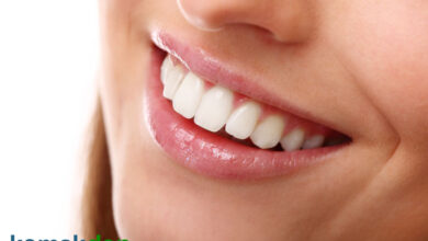 سفیدی دندان ها پس از بلیچینگ چقدر ماندگار است؟